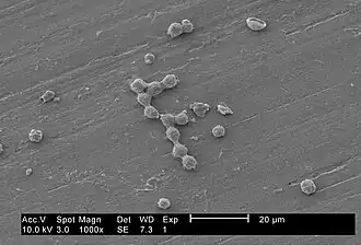 Kystes de V. vermiformis.Microscope électronique à balayage (MEB), 1000X