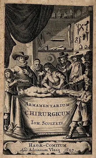 Amputation d'une jambe, illustration du traité de chirurgie de Jean Scultet, 1657