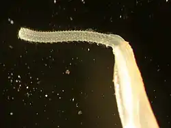 Rhadinorhynchus sp. (Palaeacanthocephala)