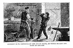 Gravure de presse montrant l'accident d'un petit enfant blessé au visage dans un atelier.