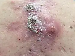 Description de cette image, également commentée ci-après