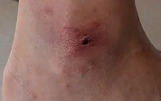 Description de cette image, également commentée ci-après