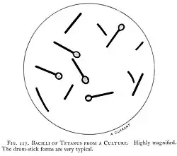 représentation très schématisée de bacilles tétaniques sous forme de bâtonnets renflés à une de leur extrémité