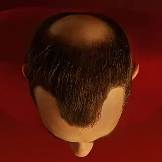 Description de cette image, également commentée ci-après