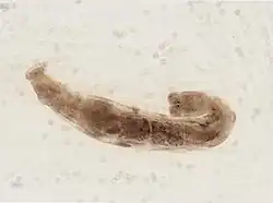 Cambarincola vitreus (Branchiobdellida)