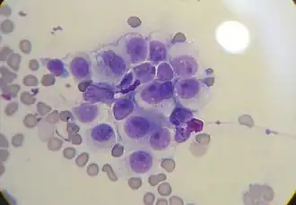 Description de l'image Canine transmissible venereal tumor cytology.JPG.