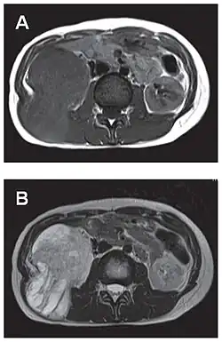 Comparaison côte à côte de deux coupes IRM.