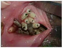 Larves de C. stimulator.