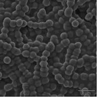 Description de l'image Colônia de streptococcus agalactiae.jpg.