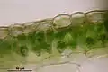 Conocephalum salebrosum, coupe transversale du thalle montrant les cellules photosynthétiques