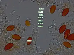 Spores et leurs mesures