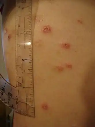 Description de cette image, également commentée ci-après