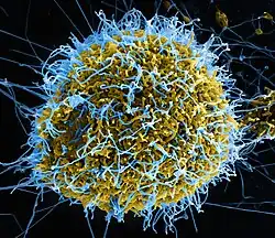 Image colorisée montrant des particules virales Ebola réalisée par microscopie électronique à balayage en juin 2014