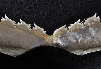 Gros-plan sur les dents.