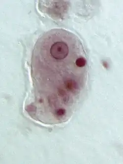 Trophozoïte d’Entamoeba histolytica.