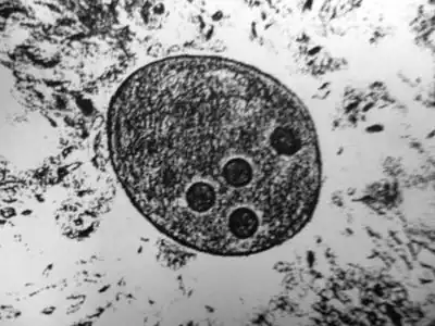 Trophozoïte de l'Entamoeba histolytica.