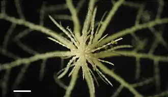 Cirrhes