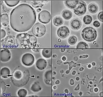 Description de l'image Four common forms of Blastocystis hominis Valzn.jpg.