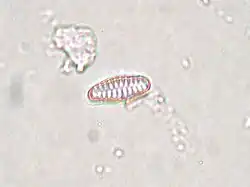 Fragilaria pinnata (vue de la sangle de ceinture).