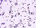 Diplocoques de S.&nbsp;pneumoniae