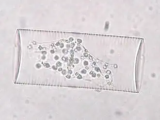 Description de l'image Guinardia flaccinia.jpeg.