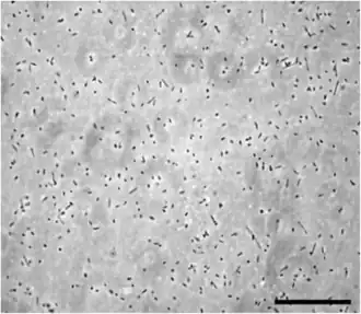 Description de l'image Halorubrum lacusprofundi ACAM34 (Anderson).png.