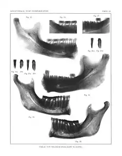 Radiographie.