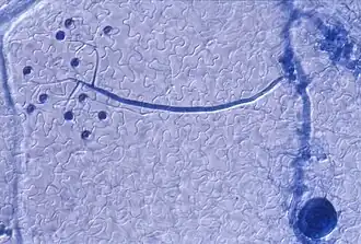 Dernière étape du cycle court de H. parasitica : apparition d'un conidiophore (structure arbusculaire bleue portant les conidiospores.