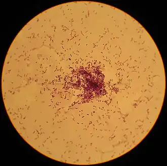 Description de l'image Lactococcus_lactis.jpg.