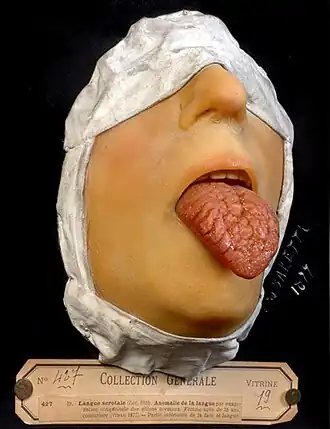 Description de l'image Langue scrotale moulage cire 1877.jpg.