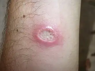 Description de cette image, également commentée ci-après