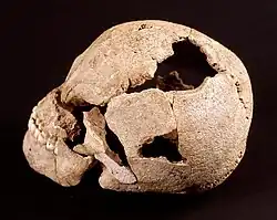 Un crâne trépané vers 4600 av. J.-C.