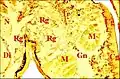 Fig.9 - Metepeira incrassata, glande rétrognathocoxale 1