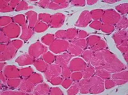 Coupe transversale d'un muscle strié squelettique.