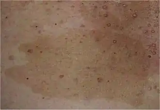 Description de cette image, également commentée ci-après