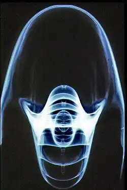 Image radiographique de nautile en agrandissement direct (foyer de 0,1mm) : axial.