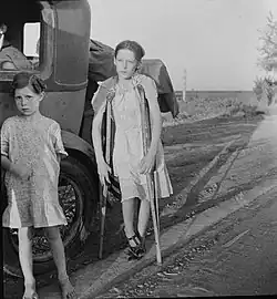 Enfants de réfugiés de la sécheresse de l'Oklahoma sur l'autoroute près de Bakersfield, en Californie. Famille de six&nbsp;personnes ; pas d'abri, pas de nourriture, pas d'argent et presque pas d'essence. L'enfant a une tuberculose osseuse. Juin 1935.