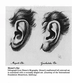 Oreille de Mozart