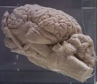 Un cerveau de couleur rose vu de profil, dans du formol.