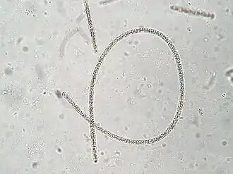 Planktothrix rubescens.