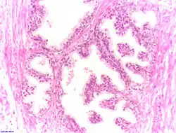 Tissus prostatiques normaux