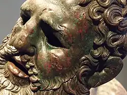 Séquelles sur le visage du pugiliste montrant la violence des combats.