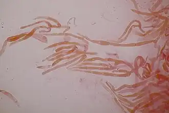 Paraphyses.
