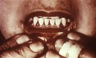 Description de cette image, également commentée ci-après