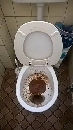 Exemple de selles anormales de type diarrhée