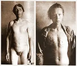 Image illustrative de l’article Scoptes