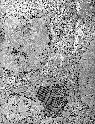 Description de l'image St. Louis Encephalitis (SLE) virus EM PHIL 1871 lores.JPG.