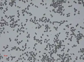 Description de l'image Stachybotrys Spores.jpg.