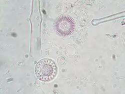 Stephanodiscus alpinus.