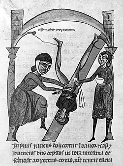 Chirurgien opérant une hernie inguinale - Rolandus Parmensis, Chirurgia, Rome : Bibliothèque Casanatense MS 1382, fol. 24v.